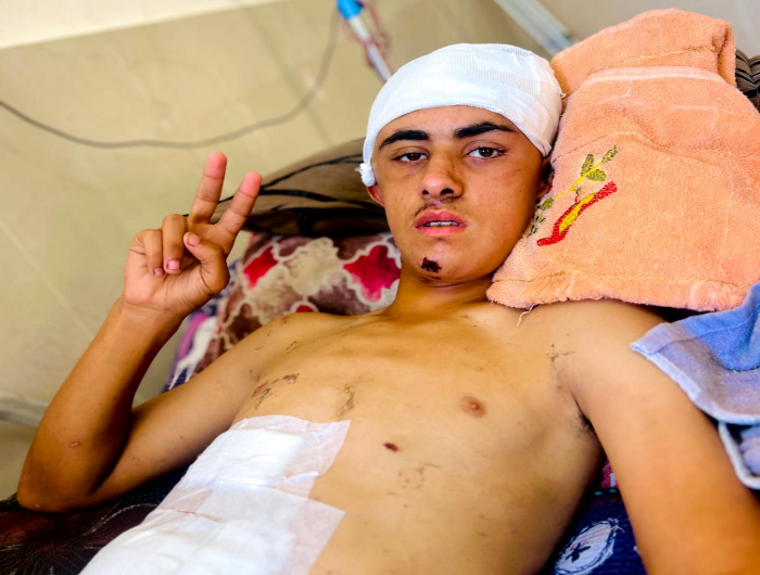 رصاصة كسرت حلم لاعب شاب في غزة